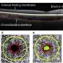 Low-dose eye drops can manage adult myopia for 24 hours