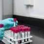 Blood biomarkers could detect earliest signs of Alzheimer's disease—and slow its progression