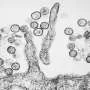 18 people in US hantavirus monitoring units, one positive