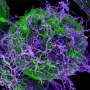 No vaccine for latest Ebola outbreak, DRC warns as toll hits 80