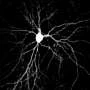 How a brain messenger protein drives progression of Alzheimer's disease