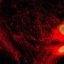 Blocking a mitochondrial transporter may curb inflammation from 'zombie' cells without killing them