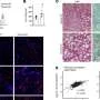 New kind of liver cell identified may protect against common liver disease