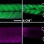 Modeling decades of muscle atrophy in weeks with new transgenic zebrafish