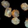 Immature immune cells predict chances of survival following a heart attack