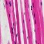 Dialing back stiffness may protect muscles in myotonic dystrophy