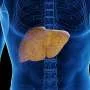 Metabolic risk factors associated with metabolic dysfunction-associated steatotic liver disease identified