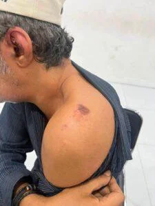Kuwaiti Tourist Allegedly Robbed of 20,000 Baht on Pattaya Beach After Arranging Overnight Companionship With Suspect
