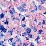 Genome editing in rats enables more accurate estrogen receptor-positive breast cancer models