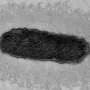 From urinary tract infection to brain abscess: How bacterial subpopulations can spread to distant body sites