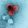 Why do some viruses linger for life? A 900,000-person study maps viral loads