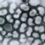 Immune system overreaction linked to deadly flu in pregnancy