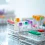 Not just insulin: Early increases in glucagon in type 2 diabetes are linked to fatty liver disease