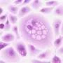 Deleting two molecular gatekeepers sharply reduces metastasis in mouse tumors