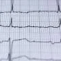 AI-powered electrocardiogram detects early signs of heart failure