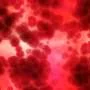 Plasma exchange could expand treatment options for rare disease that threatens vision
