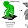A spine you can hold in your hands may help surgeons in the most challenging operations