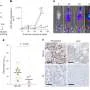 New imaging method tracks cancer from whole body to individual cells