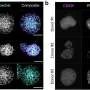 Forcing cancer cells to die can alert the immune system to enhance anti-tumor attack