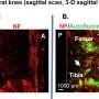 Advanced imaging uncovers 3D nerve architecture inside rat knee joints, could yield clarity on jaw joint disorders