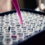 Heart-healthy lipid profile benefits brain health in adolescents, study finds